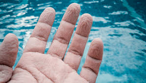 Why do wet fingers become&nbsp;wrinkly?